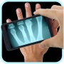 icon Xray Scanner Prank for umi Max